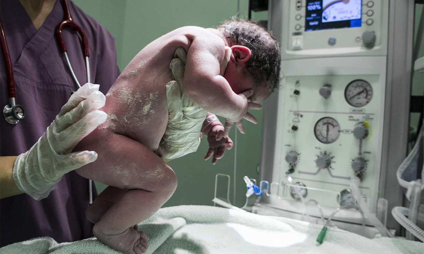 baby being born via caesarean